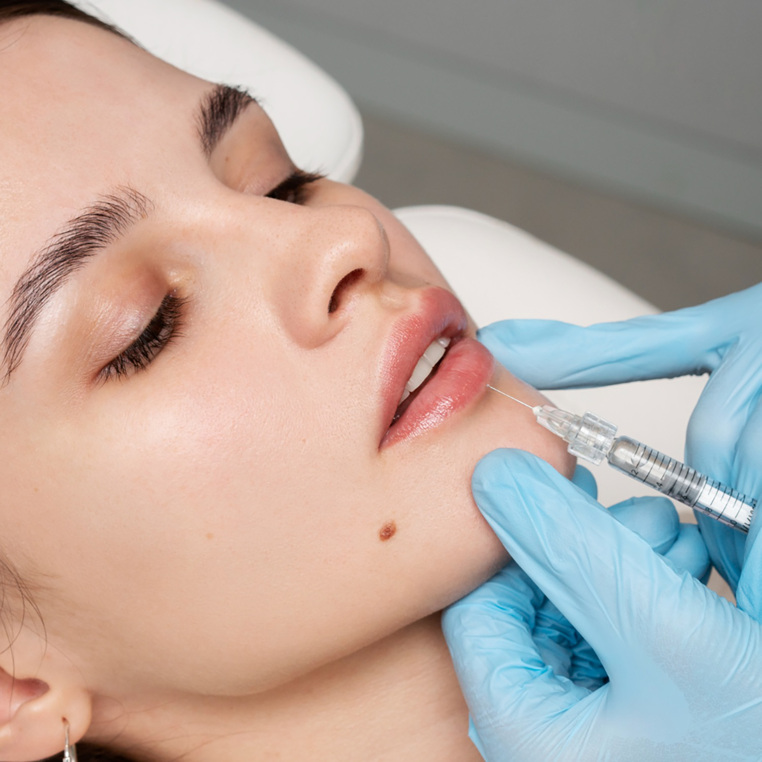 Hyalu Injection acide hyaluronique Médecine esthétique ciselure