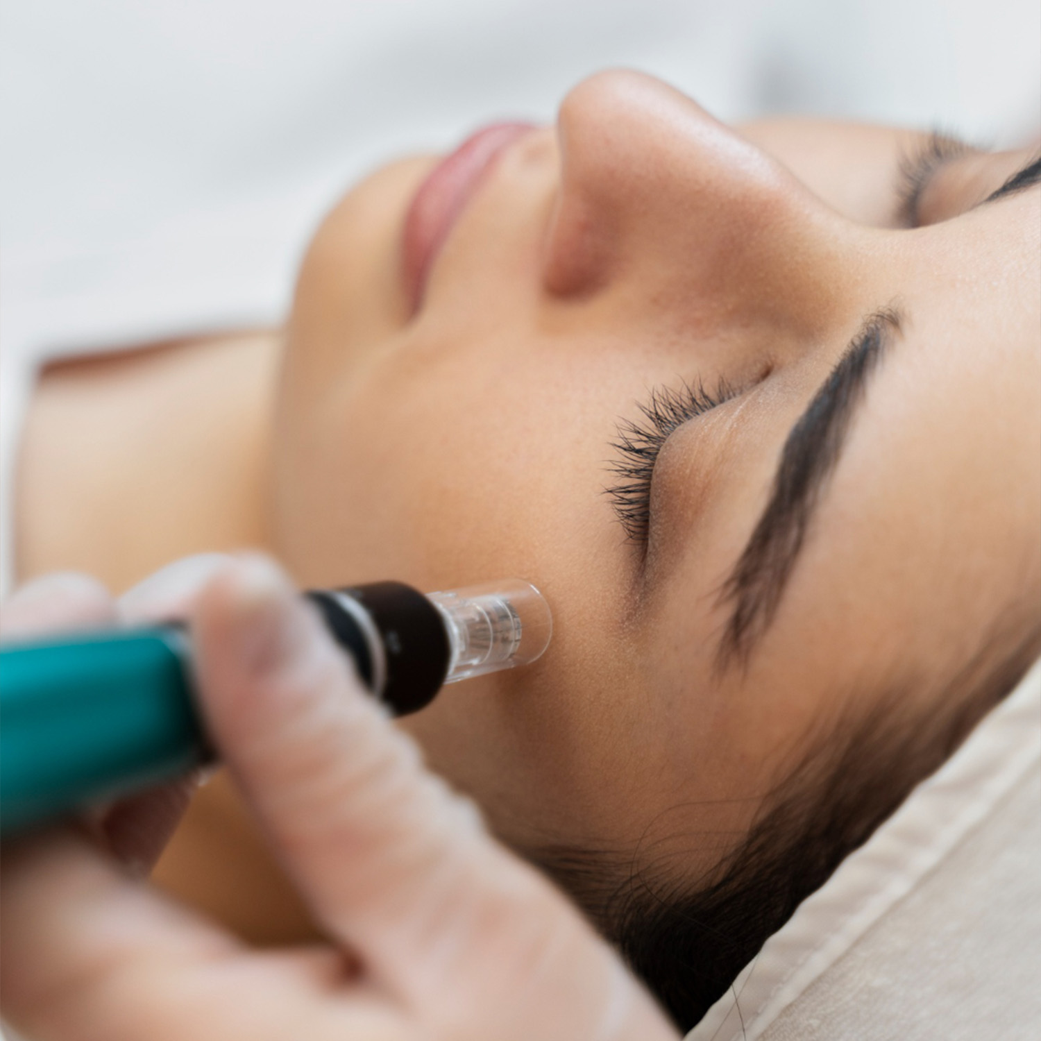 Hydrafacial Médecine esthétique ciselure